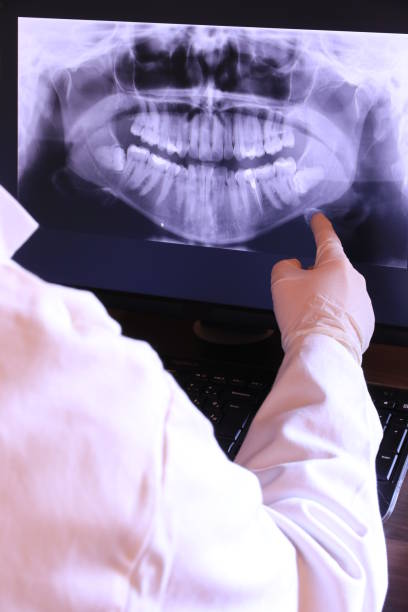 Best Emergency Wisdom Tooth Extraction in Ben Avon, PA