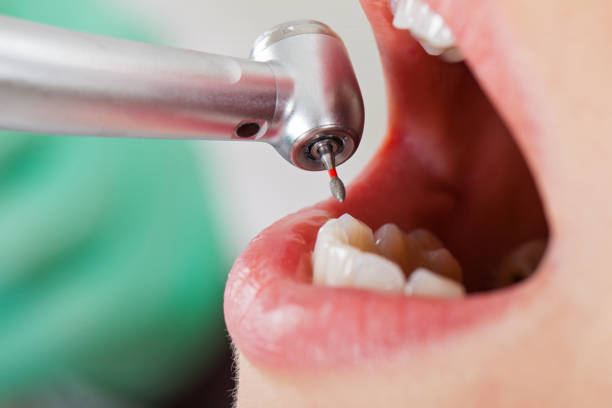 Best Broken or Chipped Tooth Repair in Ben Avon, PA